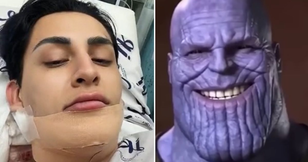 Comparan a Kunno con Thanos tras cirugía estética y él responde