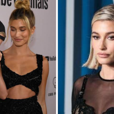 Hailey Baldwin fue hospitalizada por afección cerebral