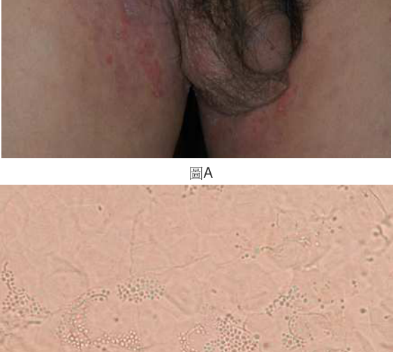 題目圖片