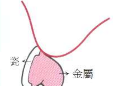 選項 A