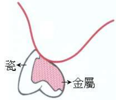 選項 B