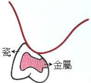 選項 D