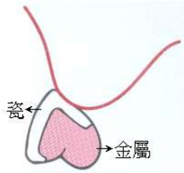 選項 C