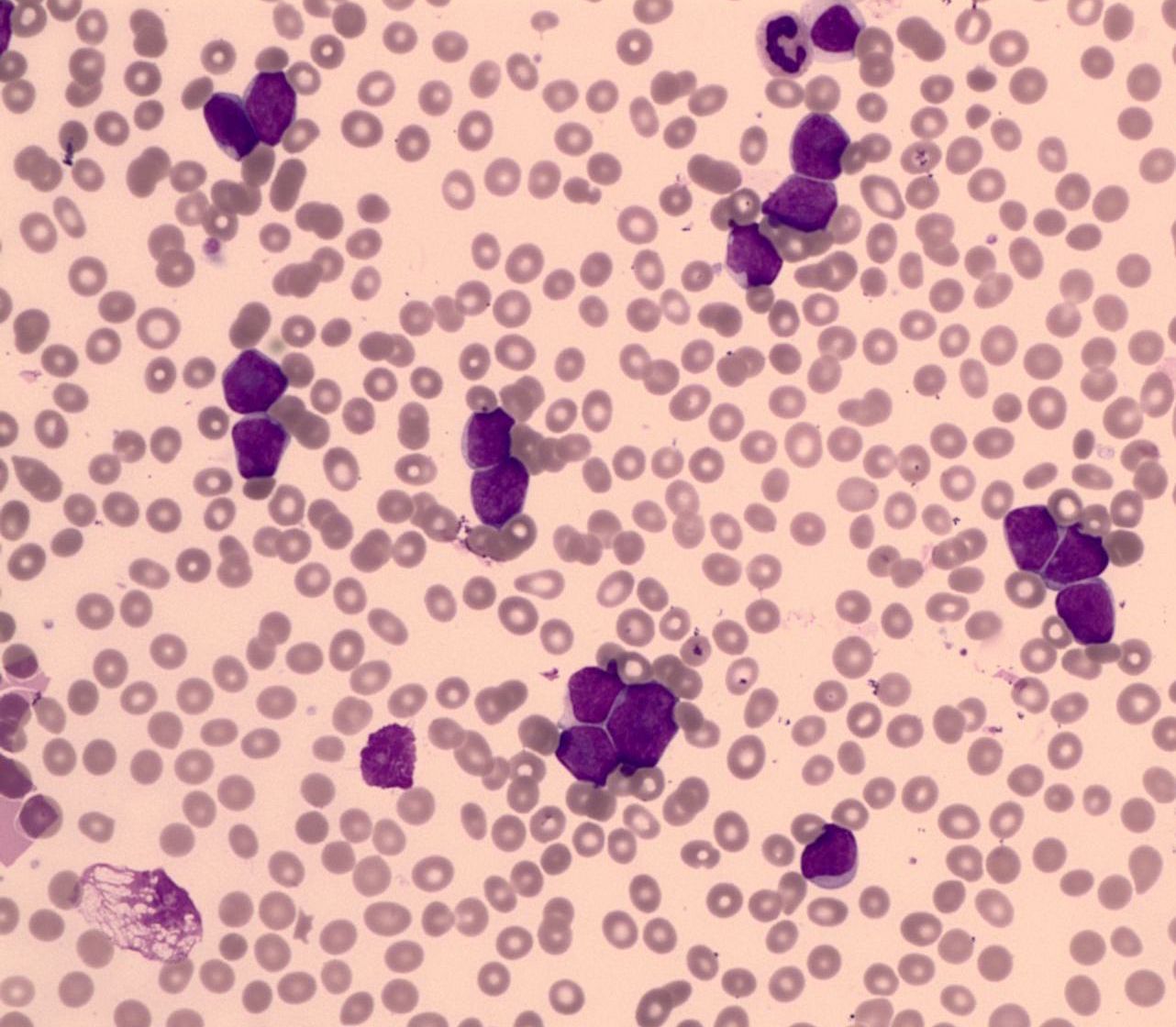 Pathology microscope image