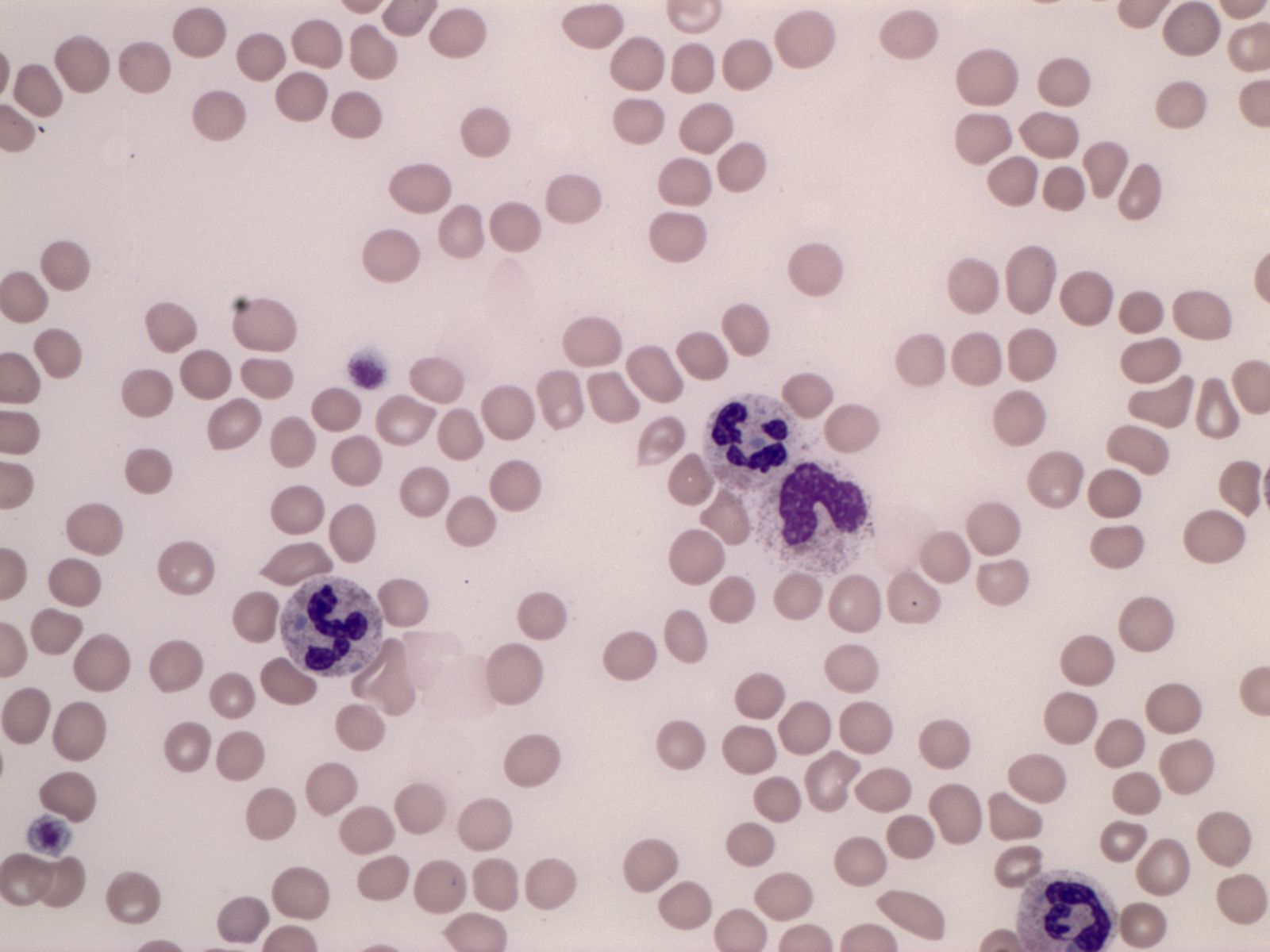 Peripheral blood smear.