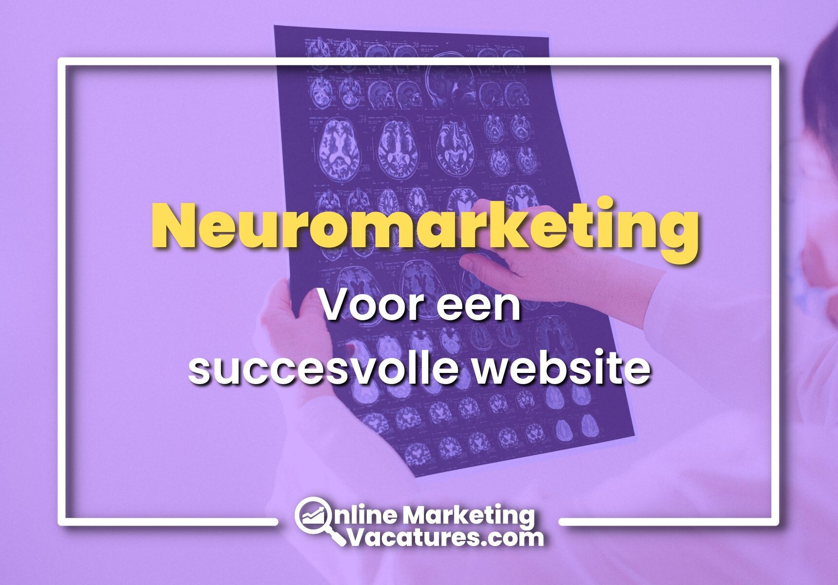 Het gebruik van neuromarketing voor een succesvolle website