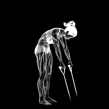 Band Back Extension demonstration