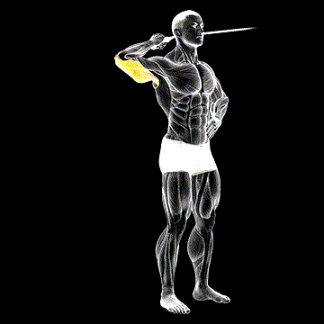 Band Side Triceps Extension demonstration