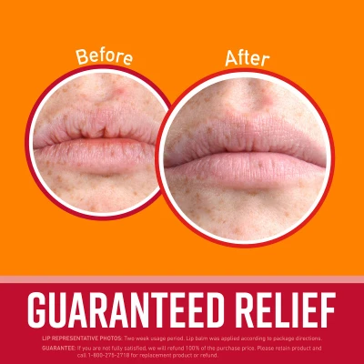 Lip Repair Balm with Cherry Flavor and Vitamin E for Moisturizing and Healing