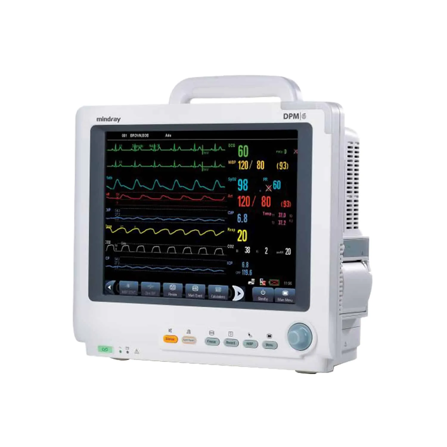 Mindray DPM6