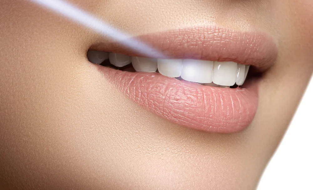 laser dentistry near