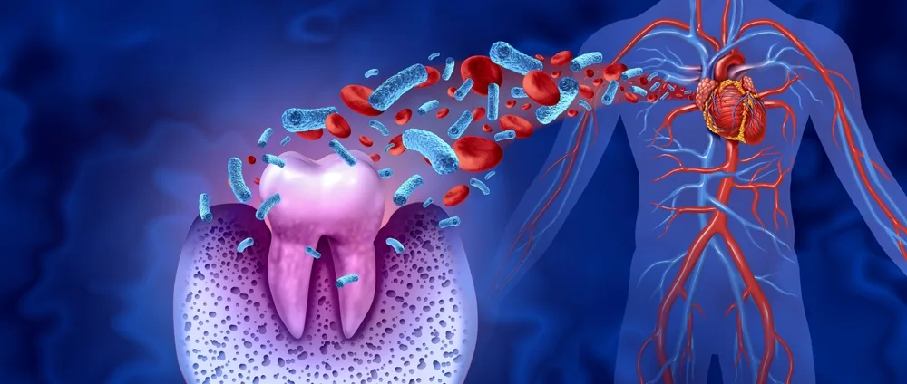 gum disease laguna niguel ca