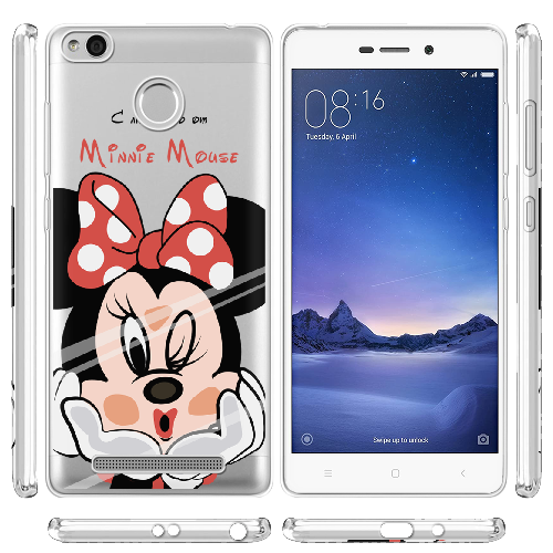 Чехол Boxface Xiaomi Redmi 3s / 3x Lady M