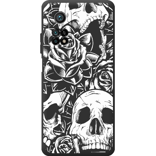 Чехол BoxFace Xiaomi Mi 10T/ Mi 10T Pro Skull and Roses