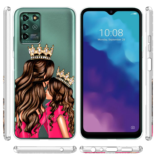 Чехол BoxFace ZTE Blade V30 Vita Queen and Princess