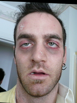 Person who looks like Vinnie Jones