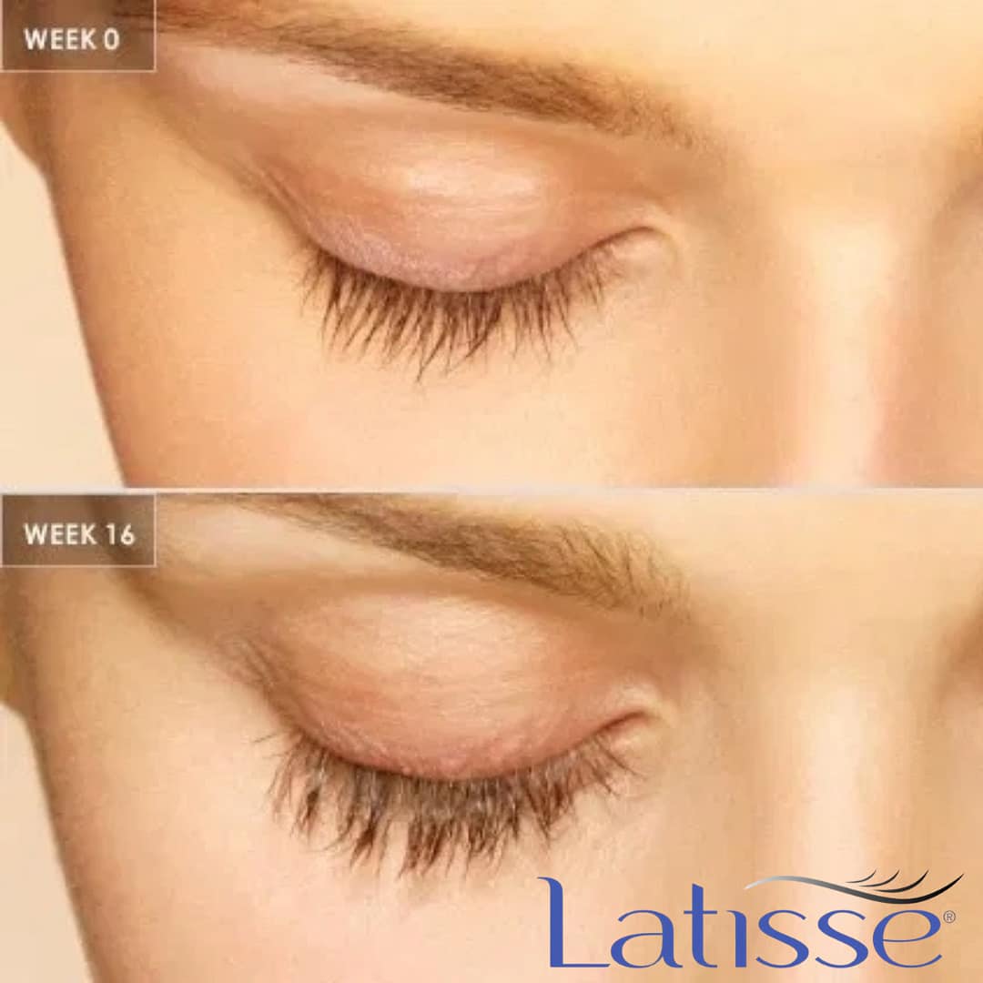 Fat reduction Overland Park Kansas