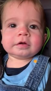 Deaf-Baby-Hears-First-Time