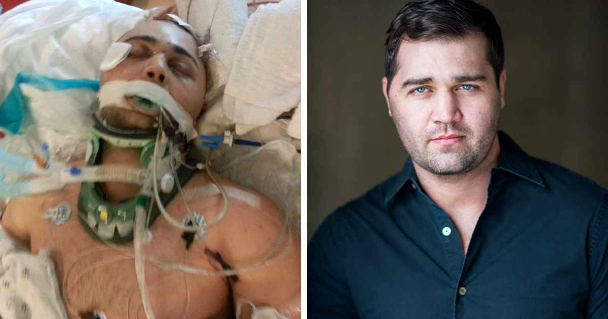 Man With No Chance Of Survival Makes Miraculous Recovery After Horrible ...