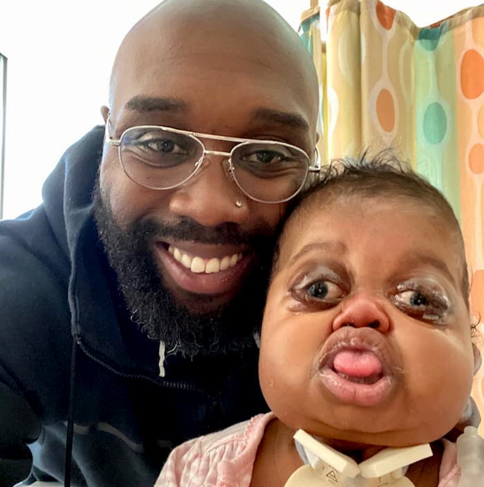 dad-writes-letter-to-baby-with-pfeiffer-syndrome-2