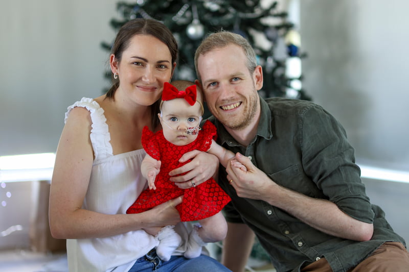 baby-born-with-organs-outside-elsie-cox-3