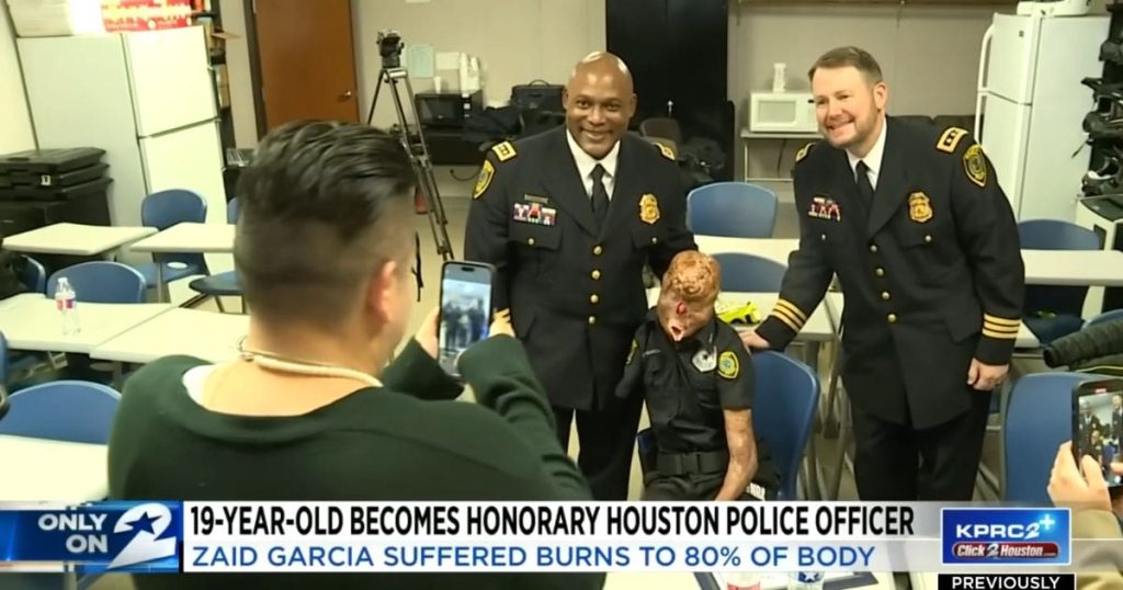 Inspiring Teen Who Suffered Severe Burns Honorary Police