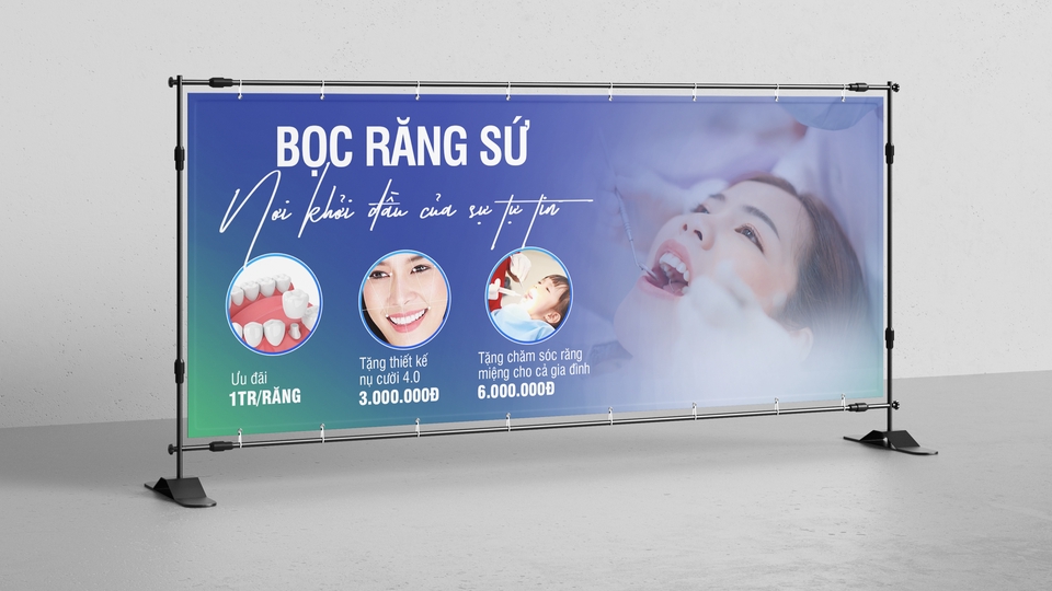 Bảng hiệu quảng cáo dịch vụ bọc răng sứ, thiết kế banner đẹp mắt, chuyên nghiệp, thu hút khách hàng.  Bọc răng sứ thẩm mỹ giá rẻ, chất lượng cao.