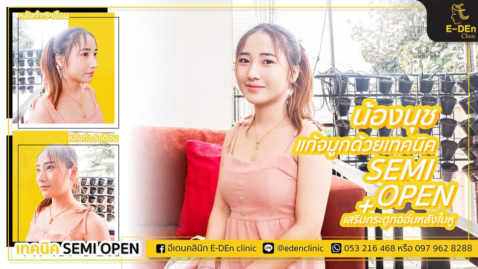 ถ่ายและตัดต่อวีดีโอ - รับตัดต่อ VDO Editor สร้างผลงานวิดีโอทุกชนิด งานไวราคาไม่แพงครับ - 9