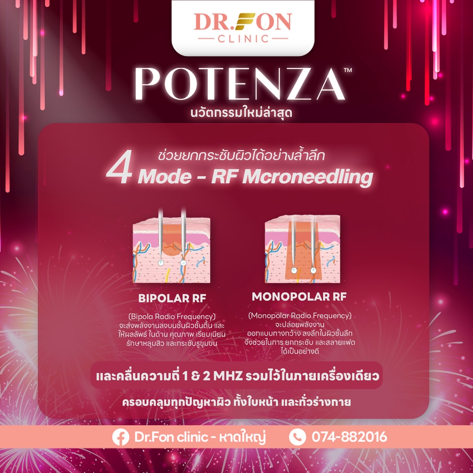 รับออกแบบแบนเนอร์ โปรโมชั่น โพเทนซ่า 4 โหมด  RF Microneedling  สำหรับคลินิกความงาม