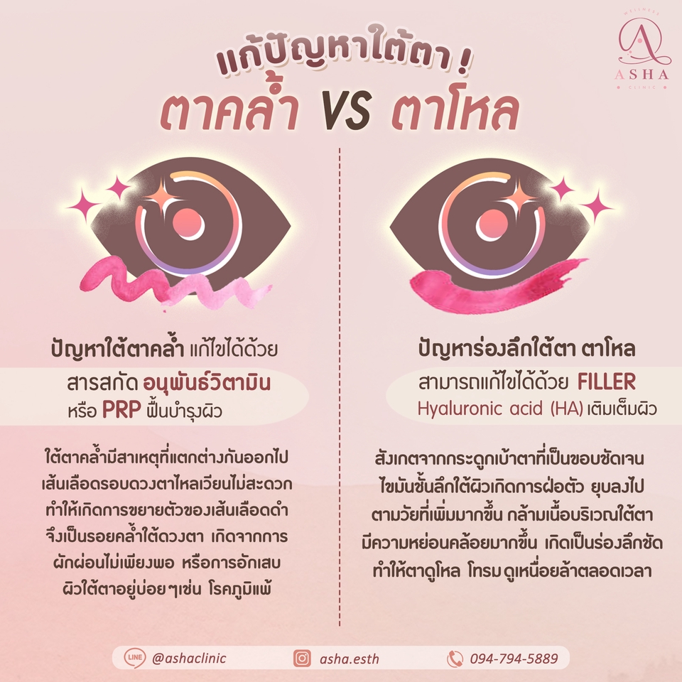 Banner โฆษณา - ออกแบบและผลิตภาพ สำหรับโฆษณา สื่อออนไลน์ทุกประเภท - 18