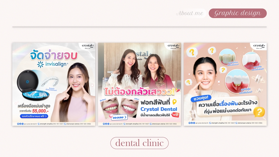 ออกแบบแบนเนอร์ทันตกรรมคลินิก Crystal Dental