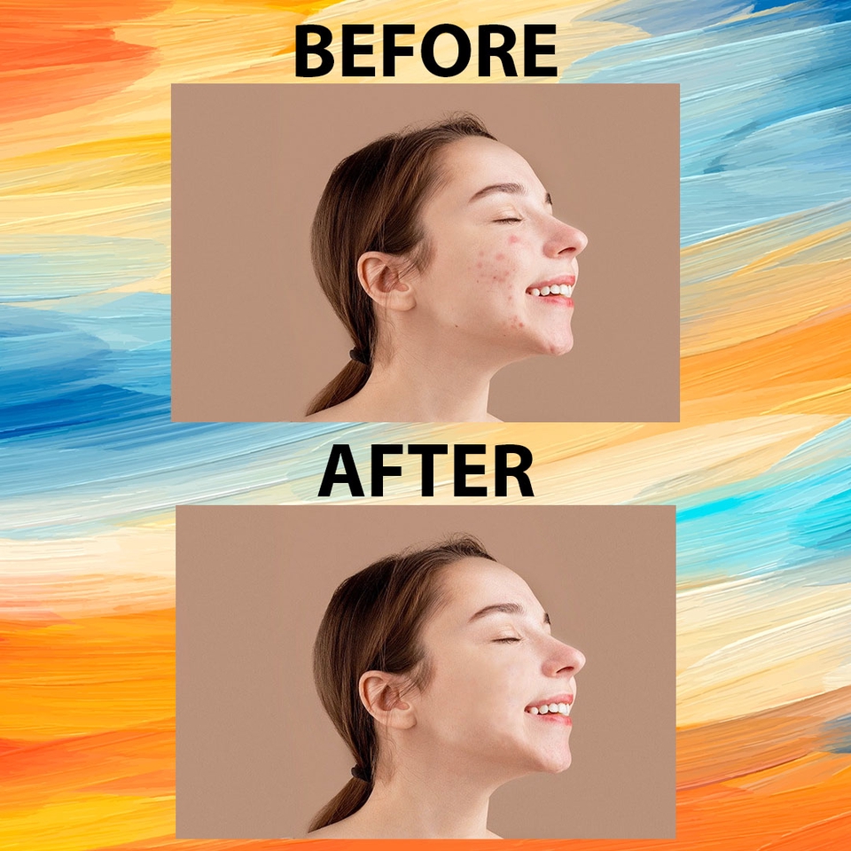 Jasa edit foto sebelum dan sesudah photoshop, edit foto online, hapus jerawat, edit foto wajah, jasa edit foto online indonesia.