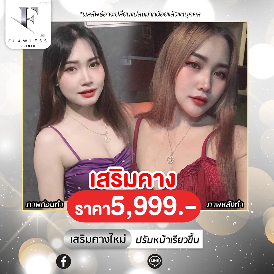 Banner โฆษณา - รับออกแบบ Banner Ads สื่อโฆษณาออนไลน์ Artwork ทุกแพลตฟอร์ม ทันสมัย - 6