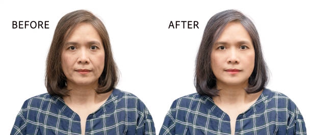 Jasa edit foto Photoshop untuk merubah warna rambut dari hitam ke abu-abu.