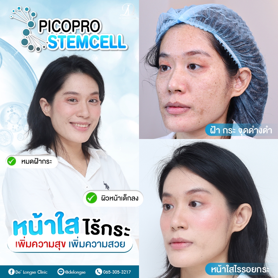 รับทำคอนเทนต์มาร์เก็ตติ้ง  วางแผนทำคอนเทนต์ วางกลยุทธ์ content marketing  ทำคอนเทนต์  facebook  youtube  tiktok   สร้างคอนเทนต์