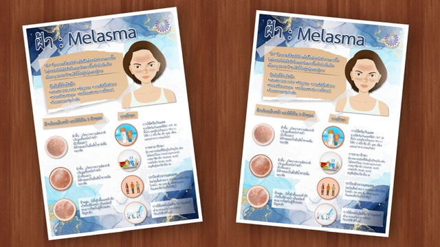 Infographics - ออกแบบ Infographic งานสวยอลังการ งานด่วนถูกใจ - 4