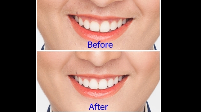 ไดคัท & Photoshop - Retouching of Faces and Bodies - 3
