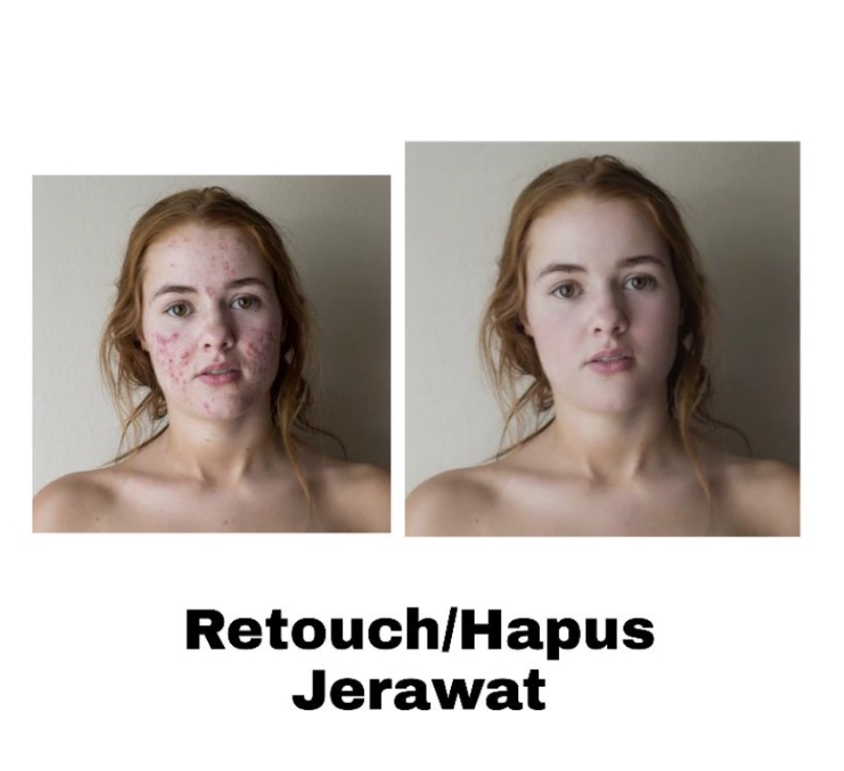 Jasa edit foto online, hapus jerawat, photoshop, edit foto wajah, edit foto prewedding.