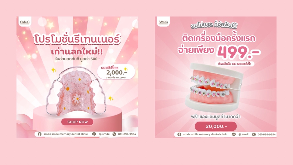 ออกแบบแบนเนอร์ facebook โปรโมชั่นจัดฟันราคาพิเศษ