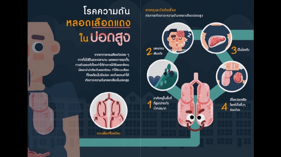 Infographics - รับงานออกทำ Infographic และ งานออกแบบอื่นๆ - 4