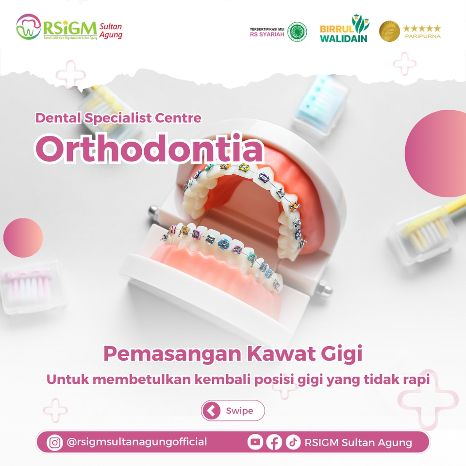 Jasa desain banner Instagram untuk promosi Orthodontia di klinik gigi RSIGM Sultan Agung, dengan desain modern dan menarik.