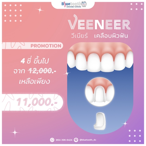 Infographics - อินโฟกราฟิก - 2