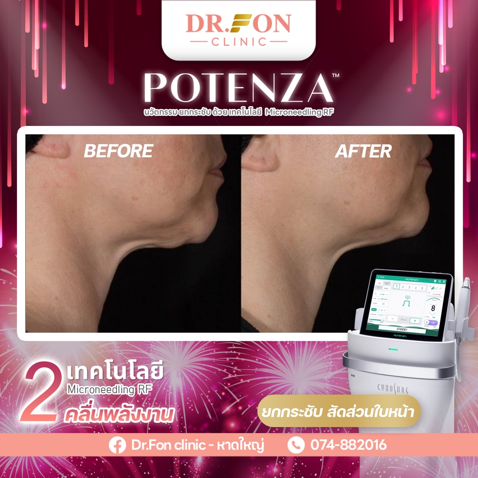 ออกแบบแบนเนอร์ Facebook  รับออกแบบแบนเนอร์ คลินิก  ออกแบบแบนเนอร์ โฆษณา  รับออกแบบ banner สวย  รับออกแบบ banner ถูก  banner สุดคุ้ม  banner คุณภาพ  banner สวยๆ  banner ราคาถูก  banner สุดปัง