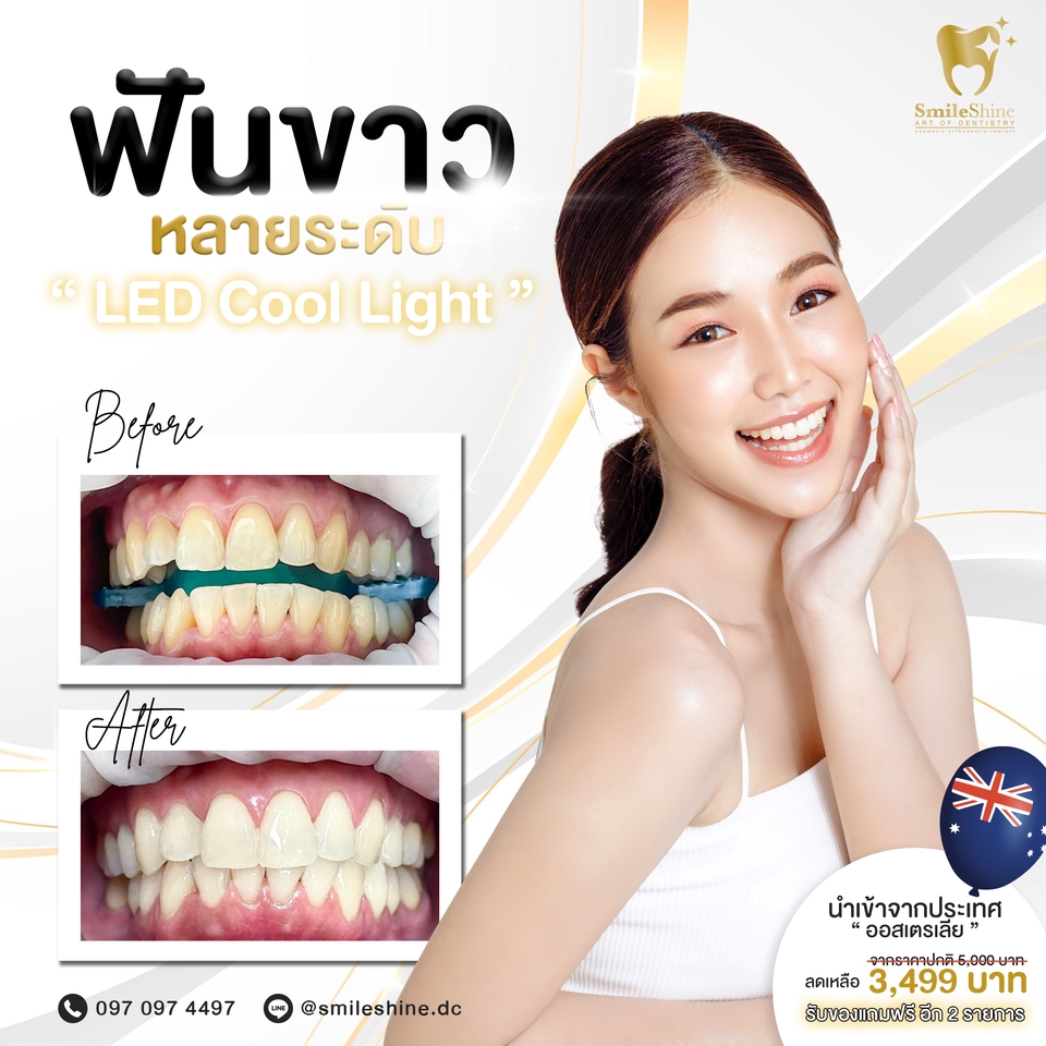 Banner โฆษณา - รับดูแล Content เพจคลินิกทันตกรรมและความงาม - 11