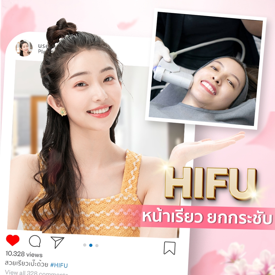 Banner โฆษณา - ออกแบบป้ายโฆษณา Banner, FB, IG, Line, Website - 4