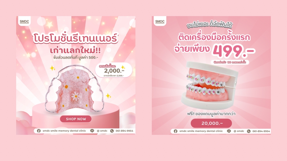 ออกแบบแบนเนอร์โปรโมชั่นทันตกรรมราคาพิเศษ