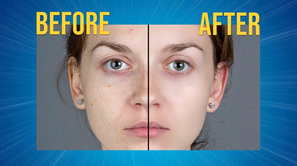 Jasa photoshop edit foto wajah, edit foto sebelum dan sesudah, hapus jerawat, edit foto online, jasa edit foto profesional