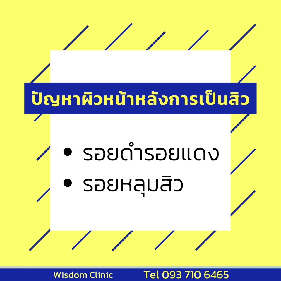 โปรโมทเพจ / เว็บ - คิดแคปชั่น เขียนคอนเทนต์ สื่อสารให้ลูกค้าเข้าใจ ชัดเจน ตัดสินใจง่ายขึ้น - 13