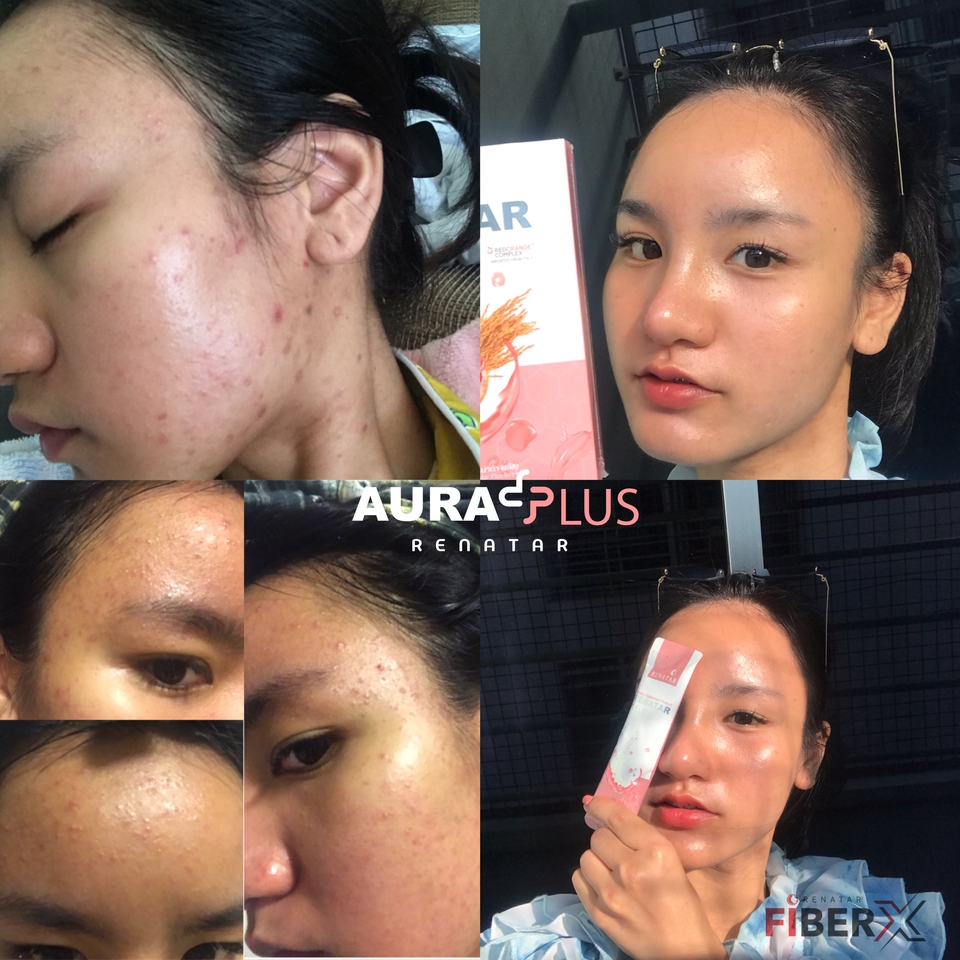 เน็ตไอดอลและบล็อกเกอร์รีวิว - รีวิวคาเฟ่ เสื้อผ้า ที่พัก และสินค้าอื่นๆ รูปภาพและวิดิโอ (FB/IG/TIKTOK) - 21