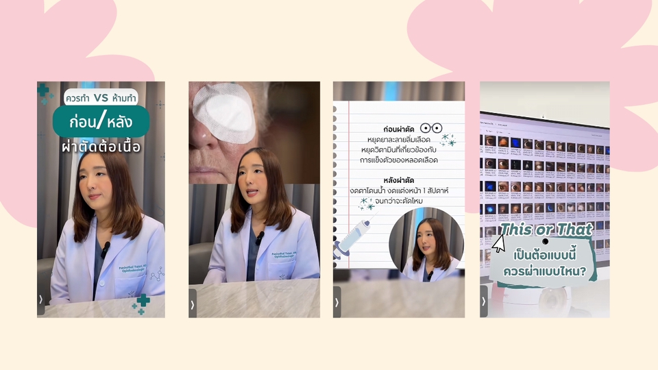 รับตัดต่อวีดีโอรีวิวศัลยกรรมต้อเนื้อ ก่อนหลัง ผลลัพธ์ชัดเจน ทำวีดีโอโปรโมทคลินิก